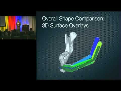 2011 Frontiers of Engineering: Additive Manufacturing is Changing Surgery