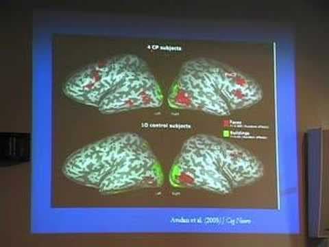 Is That My Brother? Perceptual and Neurobiological...